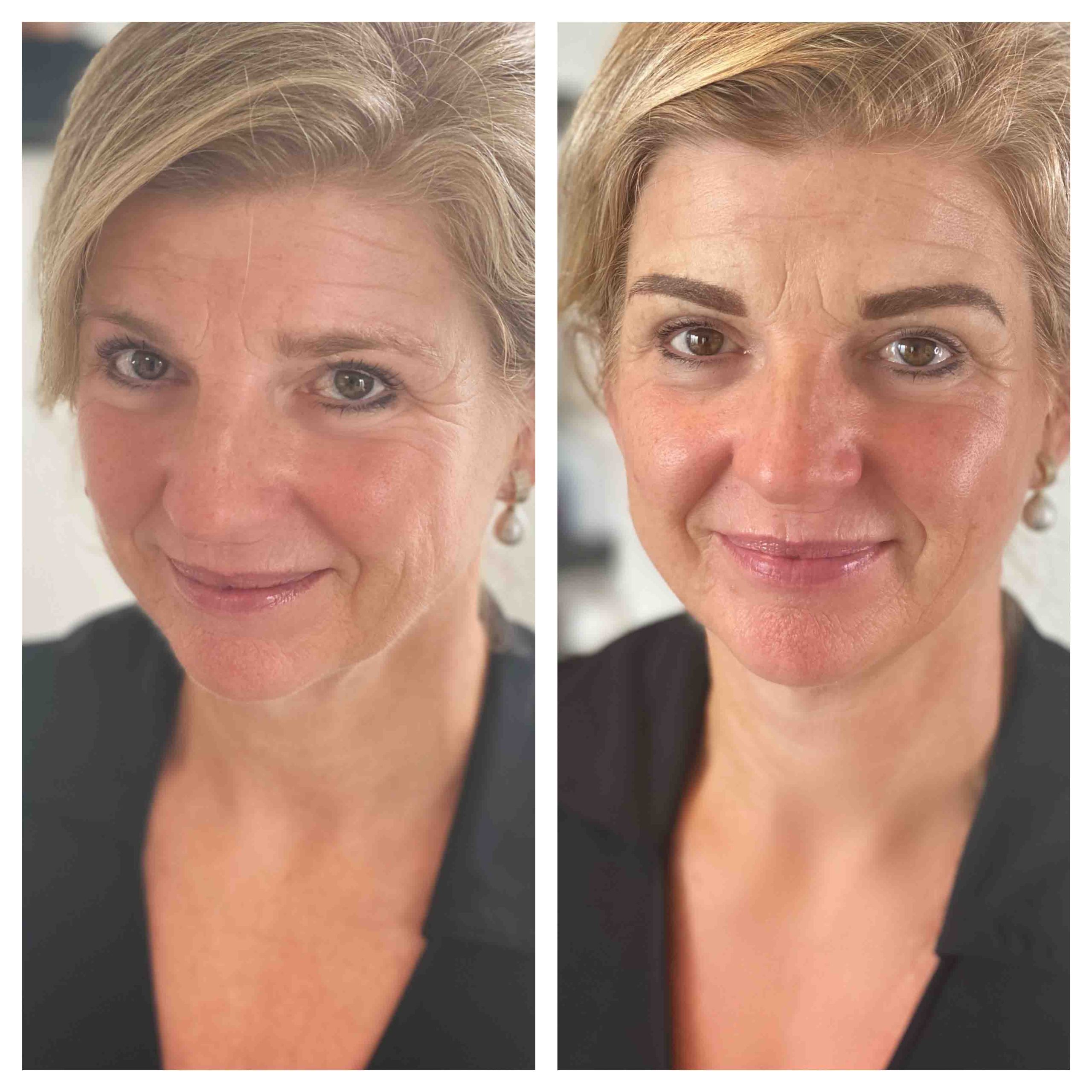 before-after-tina-pmu-specialist